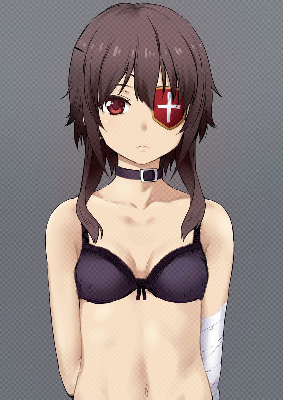 Scissoring [2nd] Secondary Erotic Image Of A Cute Girl With An Eye Patch 2 [eyepatch] Ngentot
